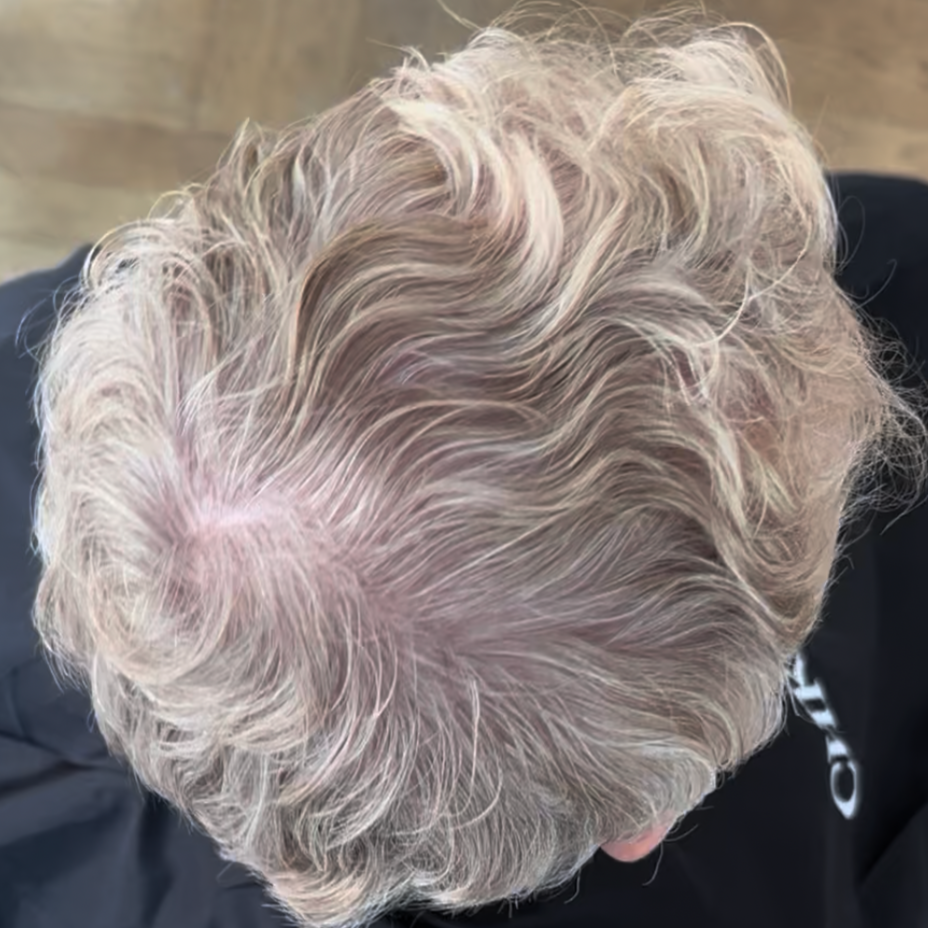 Close-up of a person with light-colored hair from behind, wearing a dark jacket.